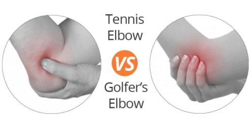 Can Golf Cause Tennis Elbow